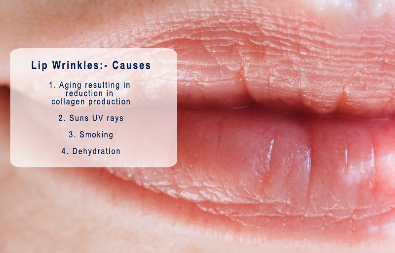 Lip wrinkles causes